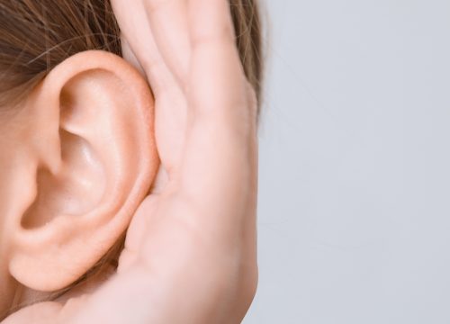 Woman's ears after otoplasty