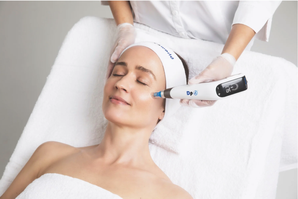 Photo of a woman receiving DP Derm microneedling treatments